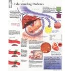 Understanding Diabetes, Laminated Chart by  Scientific Publishing