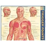 Trigger Points (Quickstudy: Academic)