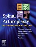 Spinal Arthroplasty with DVD: The Preservation of Motion
