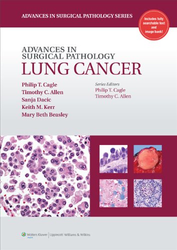Advances in Surgical Pathology: Lung Cancer