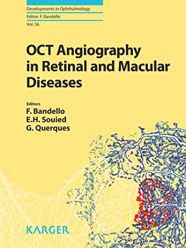 OCT Angiography in Retinal and Macular Diseases (Developments in Ophthalmology)