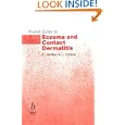 Pocket Guide to Eczema and Contact Dermatitis
