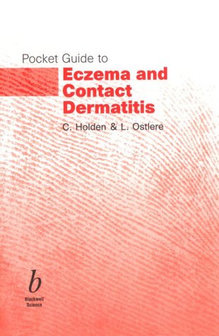 Contact-Dermatitis