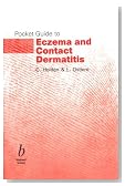 Pocket Guide to Eczema and Contact Dermatitis