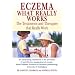 Eczema: What Really Works