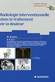 Radiologie interventionnelle dans le traitement de la douleur
