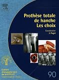 Proth�se totale de hanche : Les choix