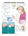 Chart - Understanding Epilepsy