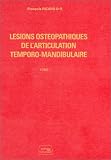 Livres Ostéopathie - Lésions ostéopathiques de l'articulation temporo-mandibulaire : Tome 1
