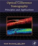 By Mark E. Brezinski: Optical Coherence Tomography: Principles and Applications First (1st) Edition