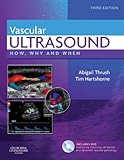 Vascular ultrasound : how, why and when