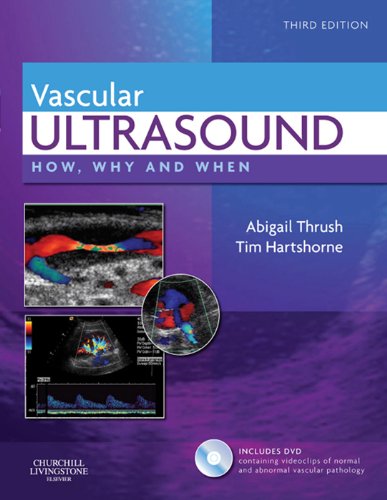 Vascular Ultrasound: How, Why and When