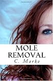 Mole Removal: How to Remove Moles and How to Remove Warts