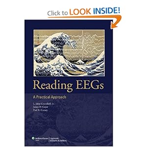 Reading EEGs: A Practical Approach: L. John 