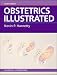 Books : Obstetrics Illustrated (Hanretty, Obstetrics Illustrated)