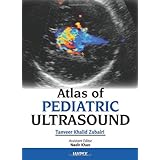 atlas of pediatric ultrasound