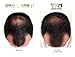 TR1 - Trichological Revolution - For Hair Loss & Thinning Hair - Men & Women
