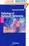 Pathology of Malignant Melanoma