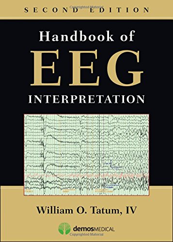Handbook of EEG Interpretation, Second Edition