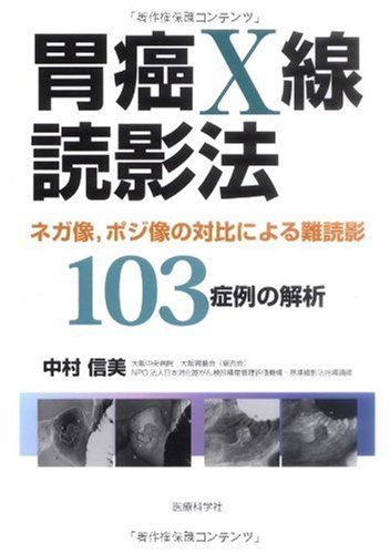 胃癌X線読影法─ネガ像,ポジ像の対比による難読影103症例の解析─のJPEG画像