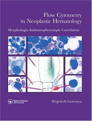 flow cytometry in neoplastic hematology