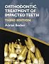 Orthodontic Treatment of Impacted Teeth