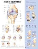 Knee Injuries Anatomical Chart