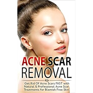 Acne Scar Removal: Get Rid of Acne Scars FAST with Natural & Professional Acne Scar Treatments for Blemish Free Skin (Acne Solution, Acne No More)