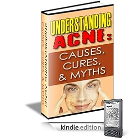 Understanding Acne : Causes, Cures, and Myths