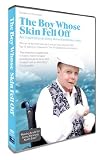 The Boy Whose Skin Fell Off  [ NON-USA FORMAT, PAL, Reg.2 Import - United Kingdom ]