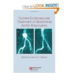 Current Endovascular Treatment of Abdominal Aortic Aneurysms by Albert G. Hakaim