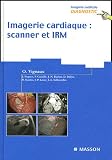 Imagerie cardiaque : scanner et IRM
