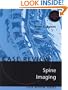 Spine Imaging: Case Review