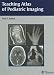 Books : Teaching Atlas of Pediatric Imaging (Teaching Atlas)