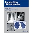 Teaching Atlas of Chest Imaging by Mark Parker, Melissa De Christenson, and Gerald Abbott