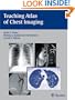 Teaching Atlas of Chest Imaging