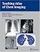 Teaching Atlas Of Chest Imaging