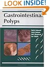 Gastrointestinal Polyps