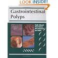 Gastrointestinal Polyps