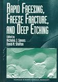 Rapid Freezing, Freeze Fracture, and Deep Etching