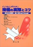 インフルエンザワクチン接種の実際とコツ―あなたの疑問・迷いをBreak through-