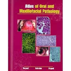 Click here to buy Atlas of Oral and Maxillofacial Pathology by Joseph A. Regezi, James J. Sciubba, and M. Anthony Pogrel.