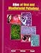 Search : Atlas of Oral and Maxillofacial Pathology