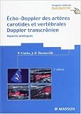 Echo-doppler des artères carotides vertébrales : Doppler transcrânien