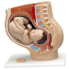 妊娠骨盤,3分解モデル