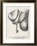 Widespread Custom is to Encircle the Penis with a Ring or Some Such Device Collections Framed Art Poster Print, 27x33