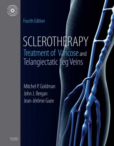 Sclerotherapy: Treatment of Varicose and Telangiectatic Leg Veins, Text with DVD