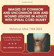 Images of Common and Uncommon Skin and Wound Lesions in Adults with Spinal Cord Injury: Historical Atlas: 1984 - 2003