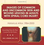 Images of Common and Uncommon Skin and Wound Lesions in Adults with Spinal Cord Injury: Historical Atlas: 1984 - 2003