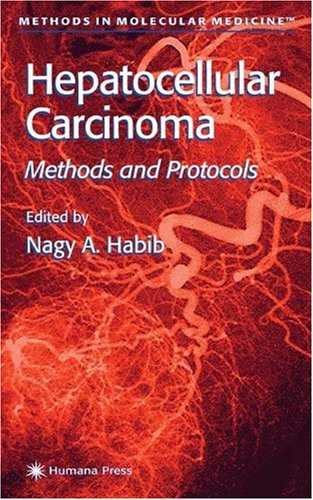 hepatocellular carcinoma methods and protocols methods in molecular medicine